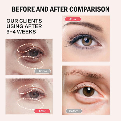 Gulfcare Store™ Retinol Eye Stick Balm