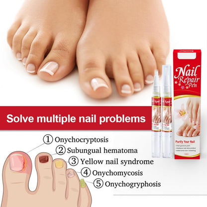Gulfcare Store™ Nail Repair Pen