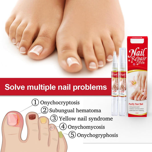 Nail Repair Pen – Strengthening & Restoration Treatment for Damaged Nails