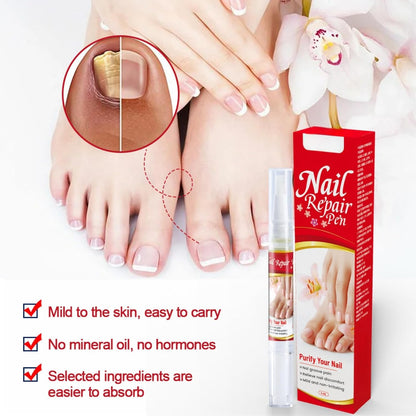 Gulfcare Store™ Nail Repair Pen
