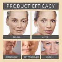 OUHOE - Bee Venom Botox Wrinkle Cream